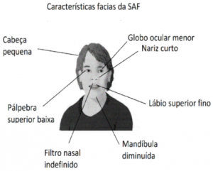 Face SAF
